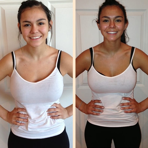 Comparative results of a spray tan transformation in Ottawa.